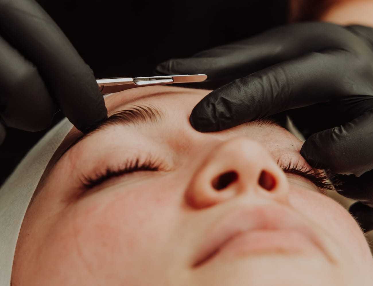 Facial close-up of a person receiving a dermaplaning treatment with a scalpel.